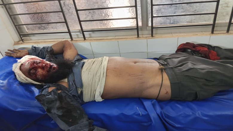 আদালতে যাওয়ার পথে সড়ক দুর্ঘটনায় কৃষকের মৃত্যু