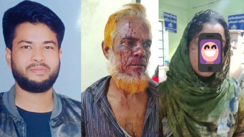 ভুরুঙ্গামারীতে যৌতুকের দাবিতে স্ত্রীকে নির্যাতন, শশুরকে কুপি